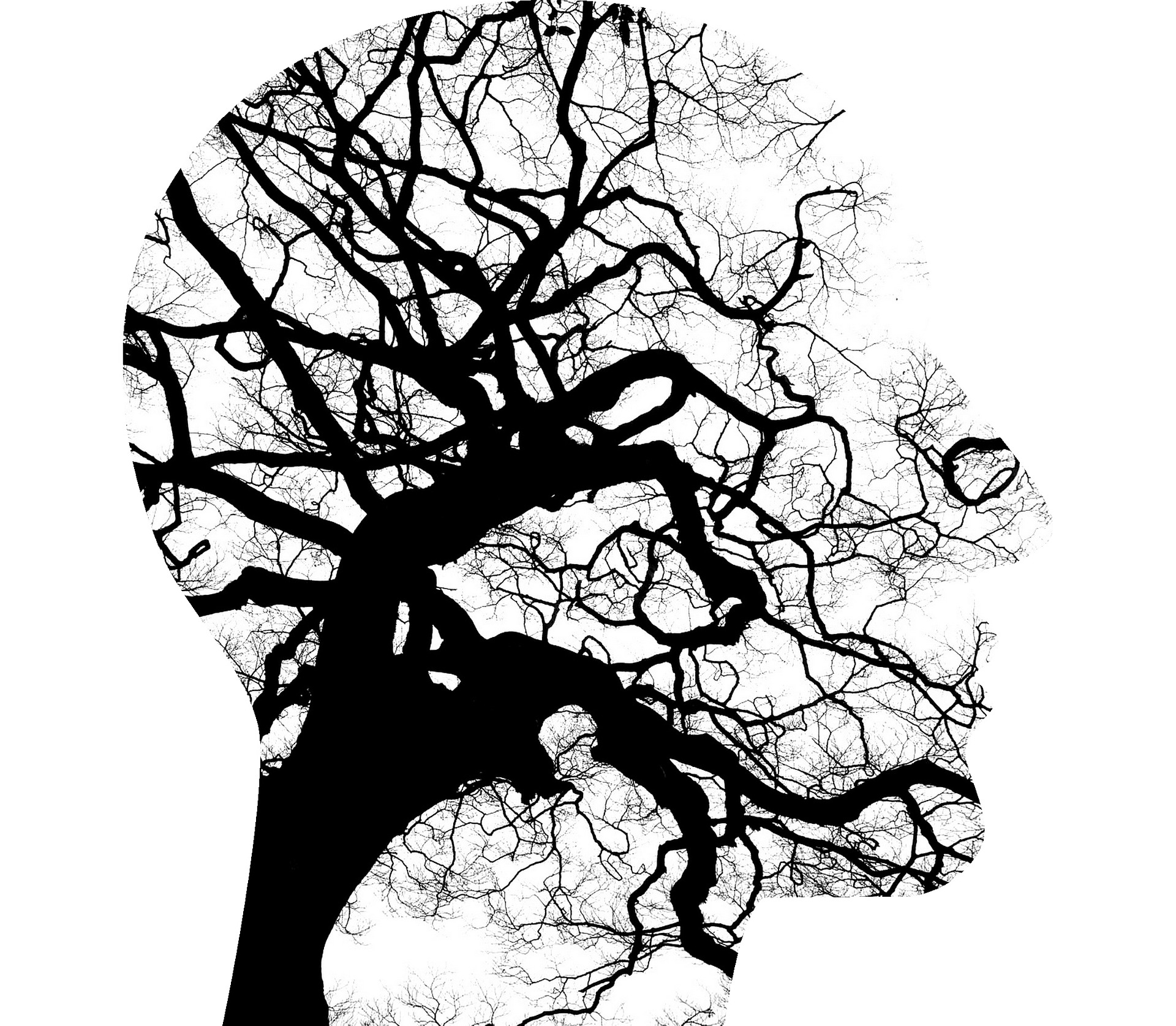 Brain tree